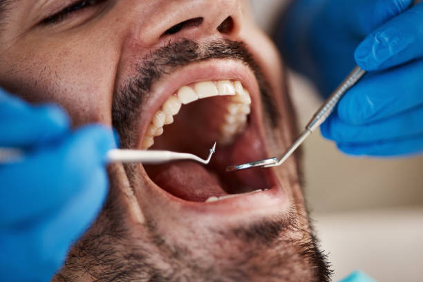 Best Emergency Dental Care for Trauma or Injury in St Marys, KS