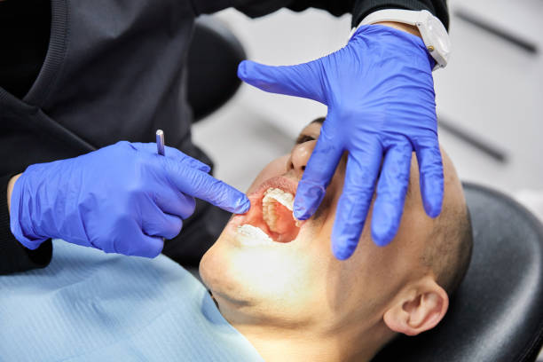Best Emergency Broken Tooth Repair in St Marys, KS